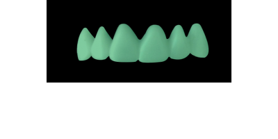 Cod.C5Facing : 10x  wax facings-bridges,  MEDIUM, Tapering ovoid, TOOTH 13-23, compatible with Cod.A5Lingual,TOOTH 13-23 for long-term provisionals preparation